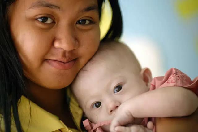 Baby Gammy mit seiner Mutter in einer emotionalen Nahaufnahme liebevoll im Arm gehalten