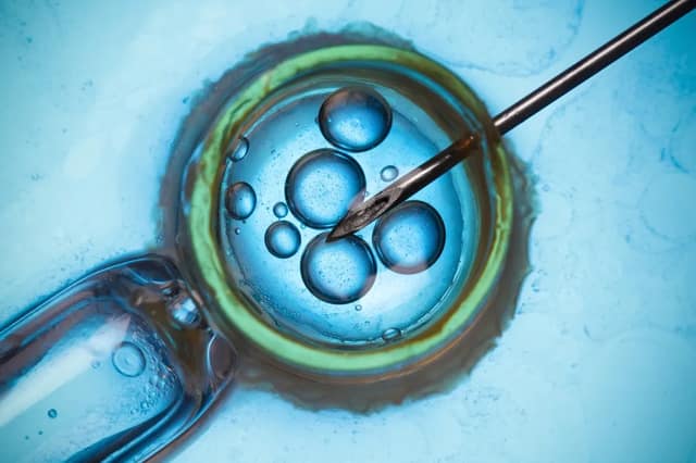 IVF Wissen Darstellung von Eizellen und mikrochirurgischer Befruchtung im Labor unter dem Mikroskop
