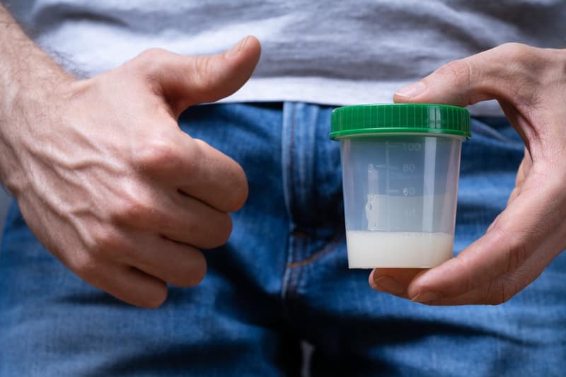 Mann hält Behälter mit Sperma für private Samenspende