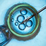 IVF Wissen Darstellung von Eizellen und mikrochirurgischer Befruchtung im Labor unter dem Mikroskop