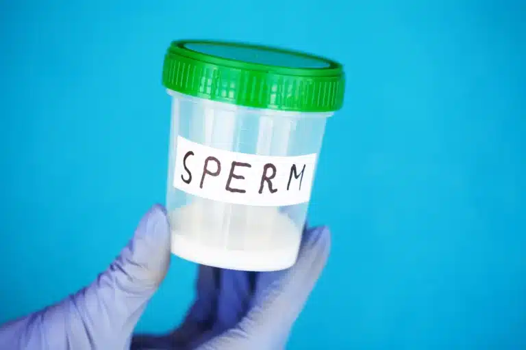 Hand-halt-einen-Behalter-mit-Sperma