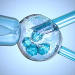 Kinderwunsch behandlung – medizinische Darstellung einer künstlichen Befruchtung (IVF) mit Injektion eines Spermiums in eine Eizelle